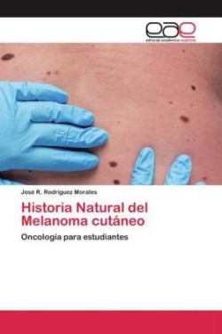 Historia Natural del Melanoma cutáneo