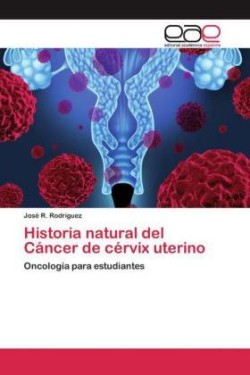 Historia natural del Cáncer de cérvix uterino