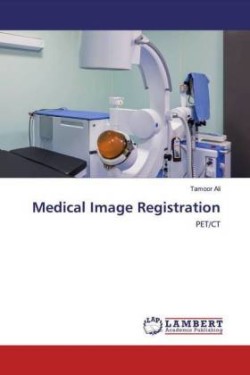 Medical Image Registration