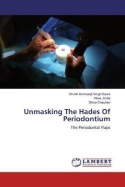 Unmasking The Hades Of Periodontium