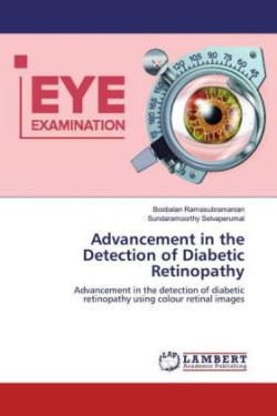 Advancement in the Detection of Diabetic Retinopathy