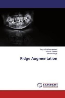 Ridge Augmentation