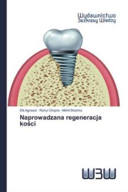 Naprowadzana regeneracja kosci