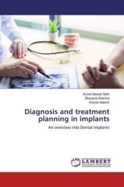 Diagnosis and treatment planning in implants