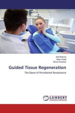 Guided Tissue Regeneration