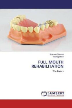 Full Mouth Rehabilitation