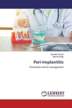 Peri-Implantitis