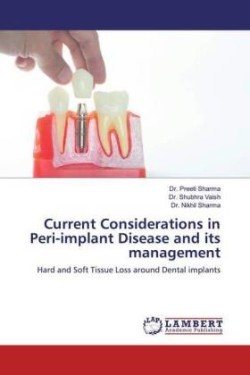 Current Considerations in Peri-implant Disease and its management