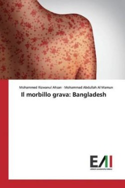 Il morbillo grava: Bangladesh