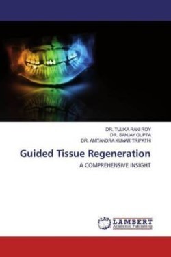 Guided Tissue Regeneration