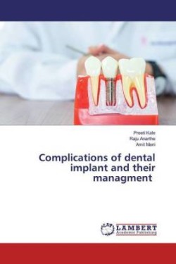 Complications of dental implant and their managment