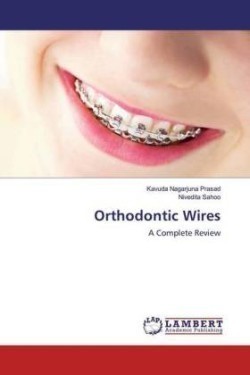 Orthodontic Wires