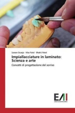 Impiallacciature in laminato