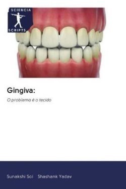 Gingiva