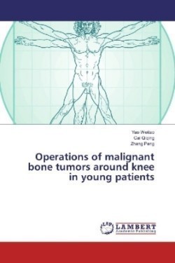 Operations of malignant bone tumors around knee in young patients