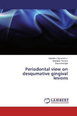 Periodontal view on desqumative gingival lesions