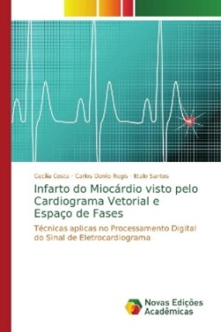 Infarto do Miocárdio visto pelo Cardiograma Vetorial e Espaço de Fases