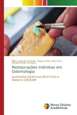 Restaurações Indiretas em Odontologia