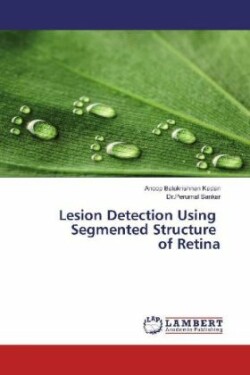 Lesion Detection Using Segmented Structure of Retina