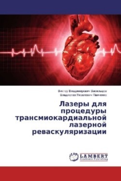 Lazery dlya procedury transmiokardial'noj lazernoj revaskulyarizacii