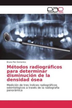 Métodos radiográficos para determinar disminución de la densidad ósea