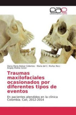 Traumas maxilofaciales ocasionados por diferentes tipos de eventos