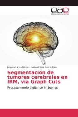 Segmentación de tumores cerebrales en IRM, vía Graph Cuts