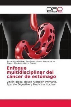 Enfoque multidisciplinar del cáncer de estómago