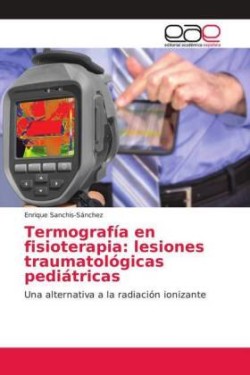 Termografía en fisioterapia