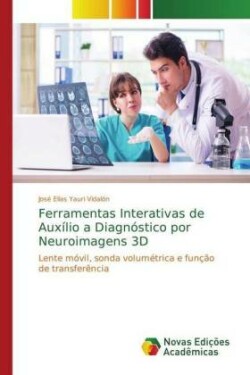 Ferramentas Interativas de Auxílio a Diagnóstico por Neuroimagens 3D