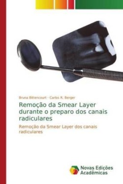 Remoção da Smear Layer durante o preparo dos canais radiculares