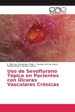 Uso de Sevoflurano Tópico en Pacientes con Úlceras Vasculares Crónicas