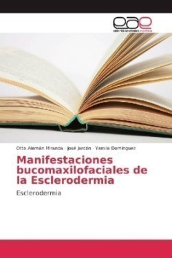 Manifestaciones bucomaxilofaciales de la Esclerodermia