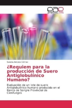 ¿Requiem para la producción de Suero Antiglobulínico Humano?