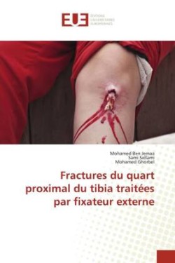 Fractures du quart proximal du tibia traitées par fixateur externe