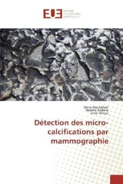 Détection des micro-calcifications par mammographie