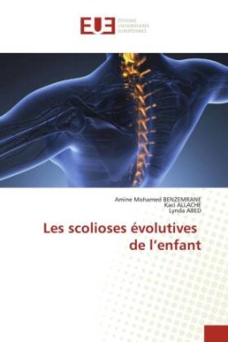 Les scolioses évolutives de l'enfant