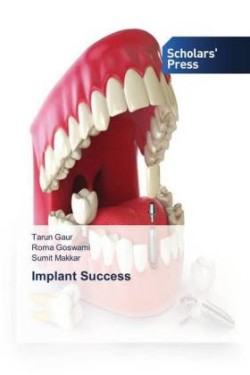 Implant Success