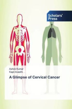 A Glimpse of Cervical Cancer