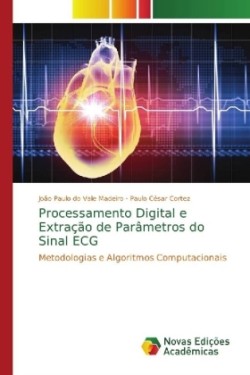 Processamento Digital e Extração de Parâmetros do Sinal ECG