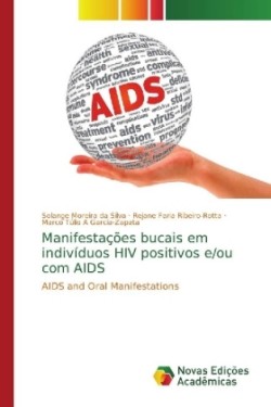 Manifestações bucais em indivíduos HIV positivos e/ou com AIDS