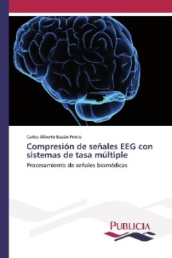 Compresión de señales EEG con sistemas de tasa múltiple