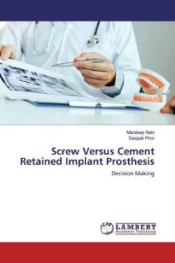 Screw Versus Cement Retained Implant Prosthesis
