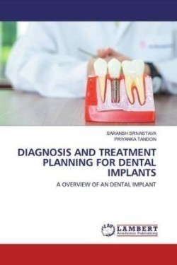 DIAGNOSIS AND TREATMENT PLANNING FOR DENTAL IMPLANTS