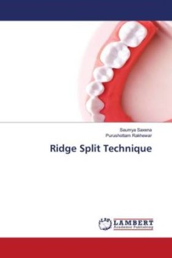 Ridge Split Technique