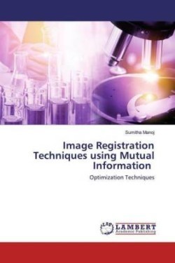 Image Registration Techniques using Mutual Information