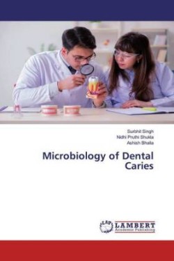 Microbiology of Dental Caries