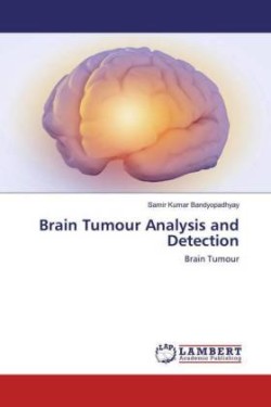 Brain Tumour Analysis and Detection