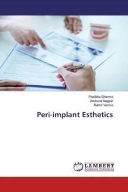 Peri-implant Esthetics