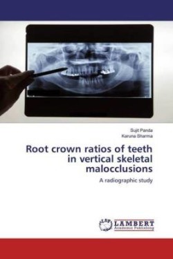 Root crown ratios of teeth in vertical skeletal malocclusions